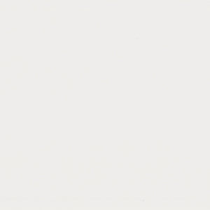 Yellow White 02 - 2" Aluminum Horizontal Blind